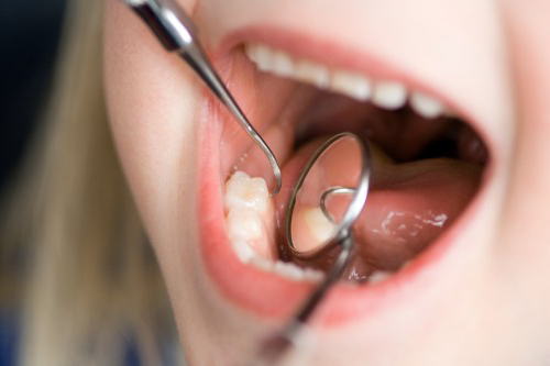 دندانپزشکی کودکان و درمان آسیب های دندانی